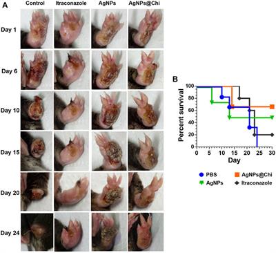 Silver Chitosan Nanocomposites are Effective to Combat Sporotrichosis